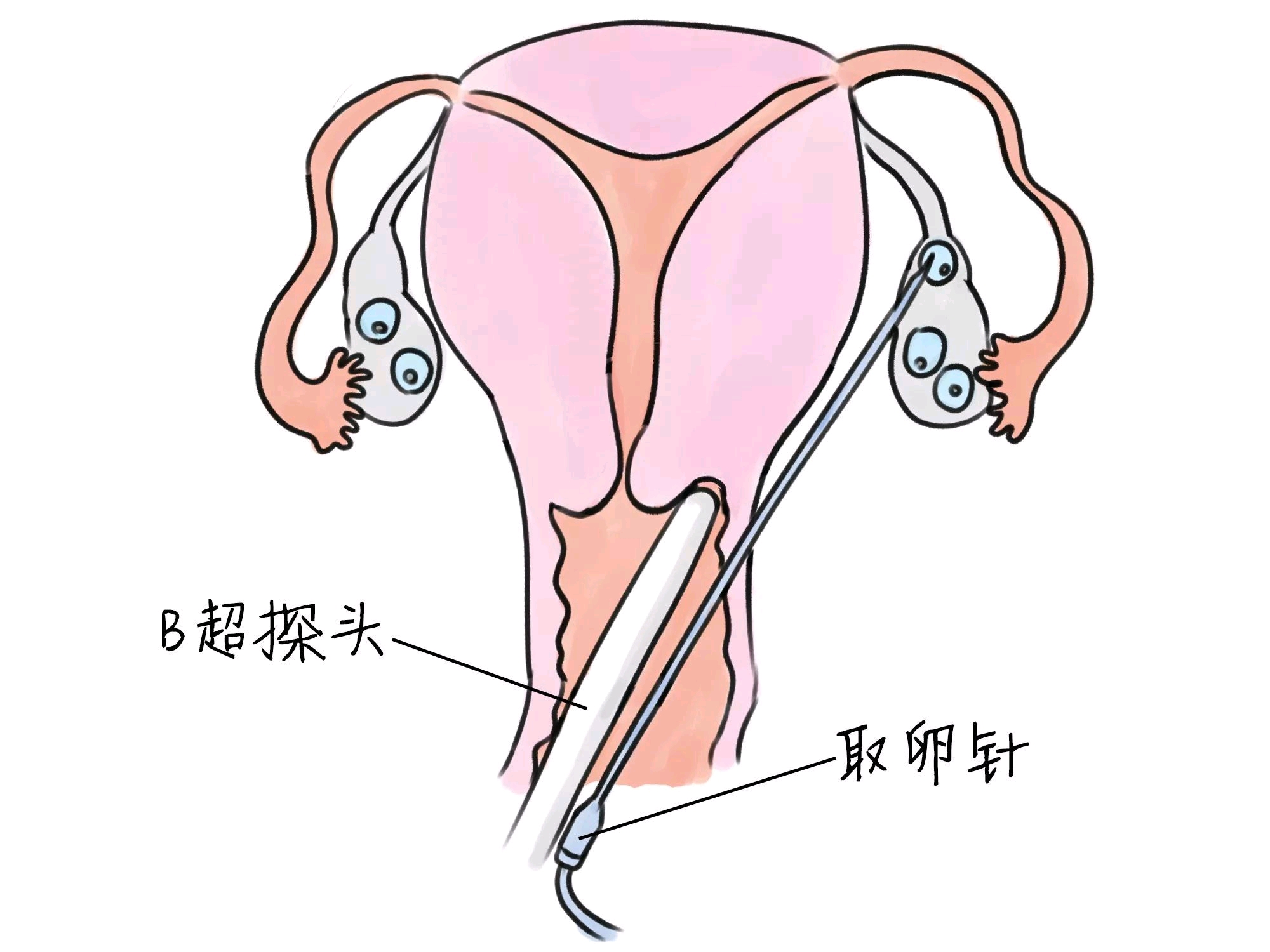 助孕瑜伽