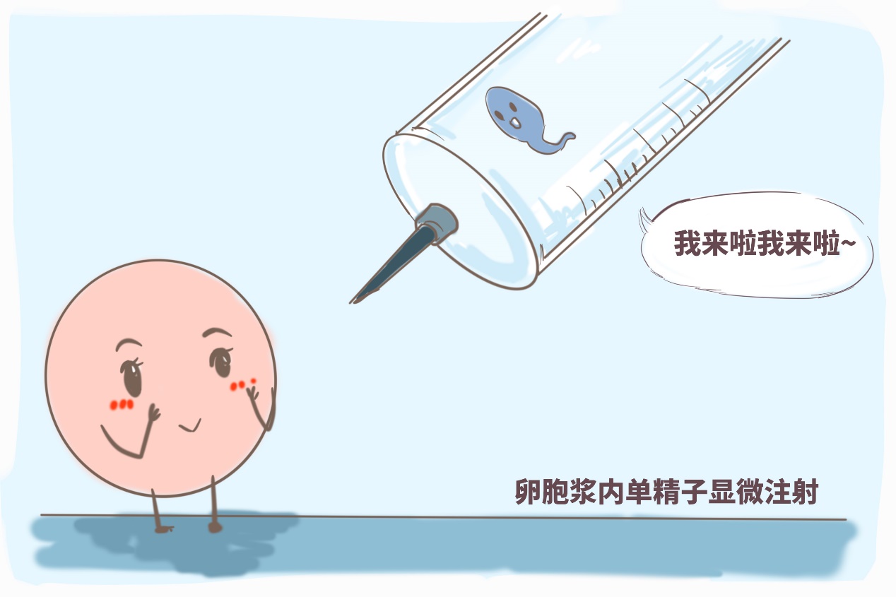 辅助生殖技术