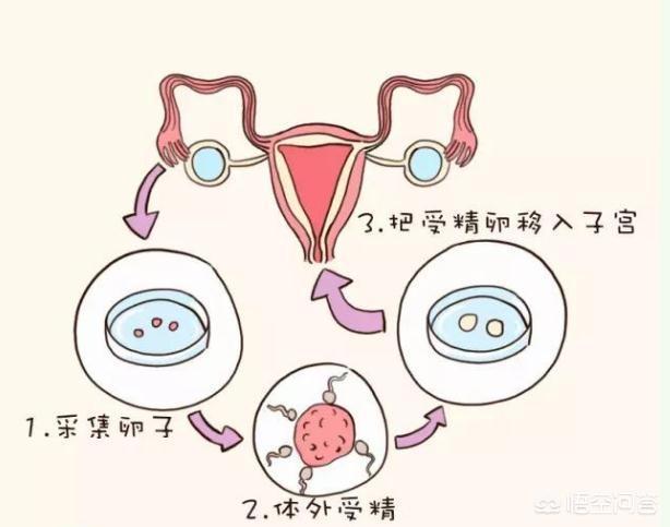 助孕
