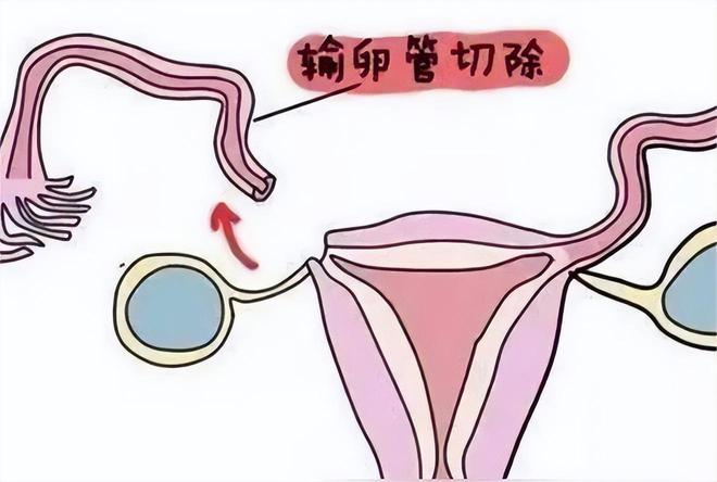 丽水供卵代怀